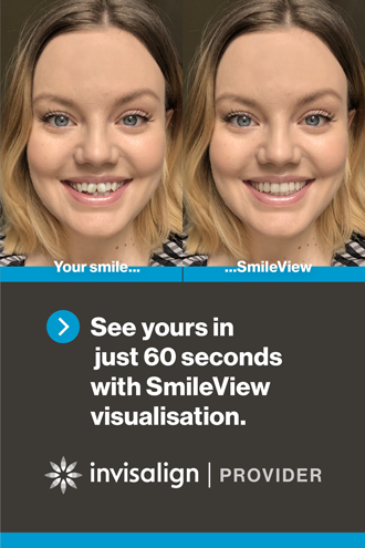 Invisalign Smile View